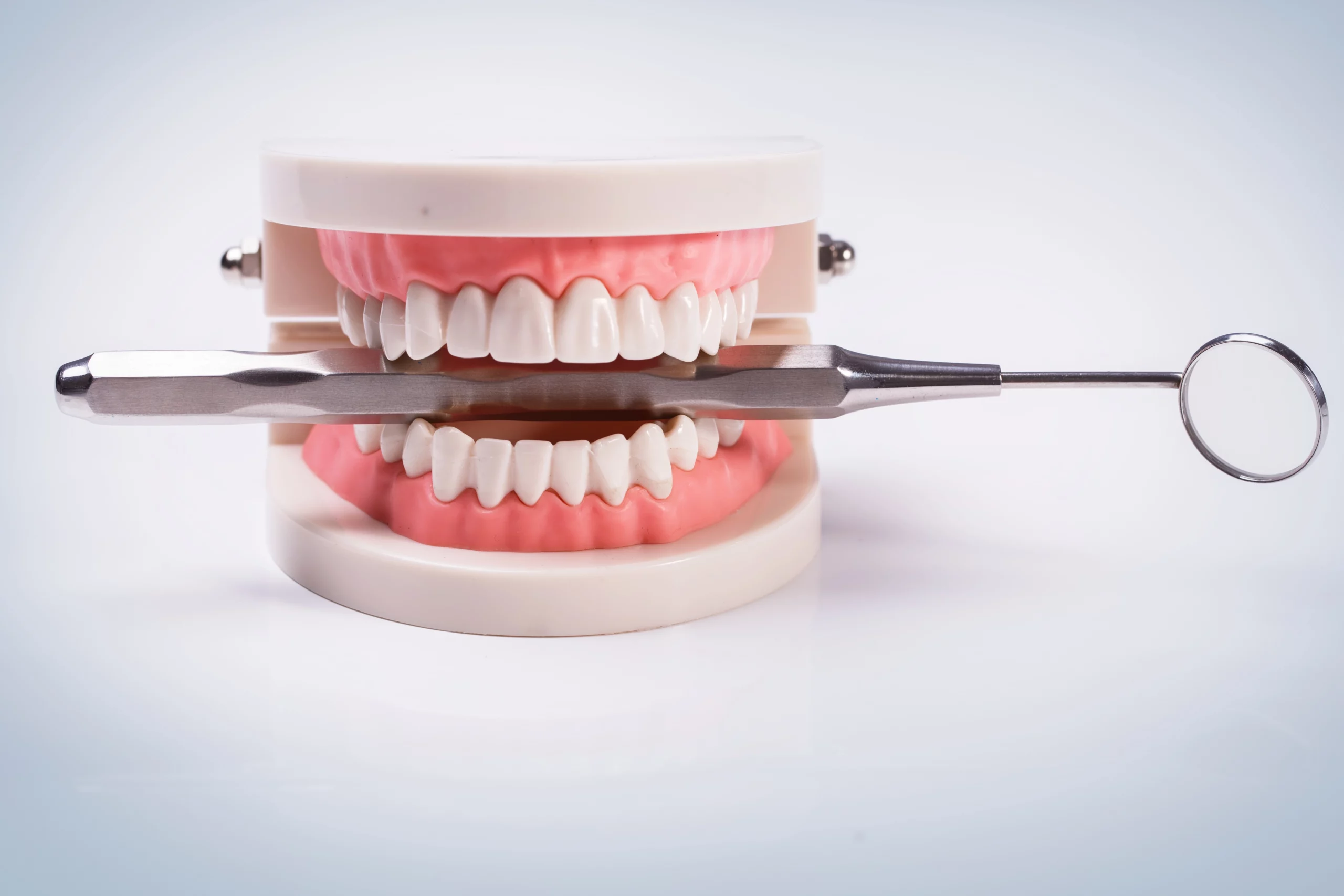Implant Dentaire à l’Étranger : Considérations Cruciales pour Votre Santé Bucco-Dentaire